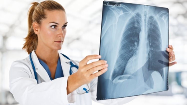 zatürre-hastalığı